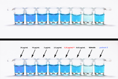 Test Elisa - réaction antigène-anticorps